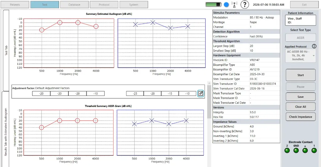 [HW190.OP03] Integrity V500 ASSR License